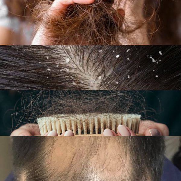 HAIR CONCERNS - After