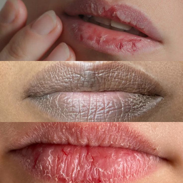 LIP CONCERNS - After